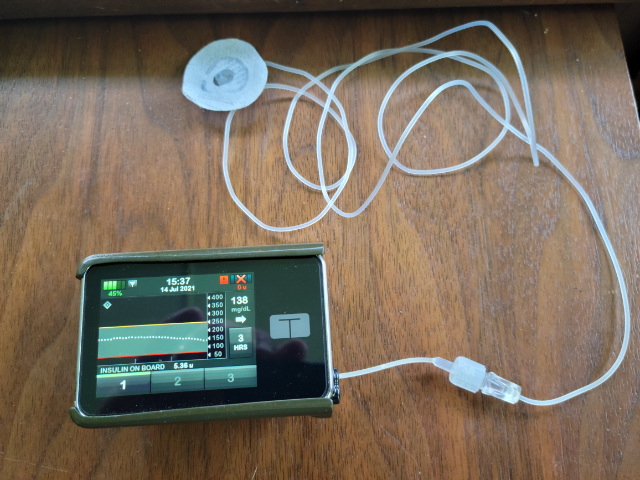 t:slim X2 insulin pump with infusion set attached