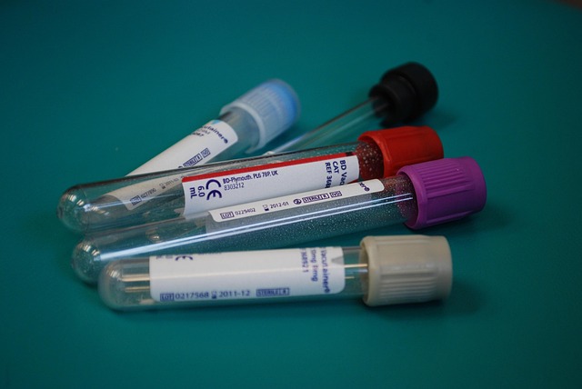 5 lab testing vials for blood tests, each with a different color cap | A Cancelled Lab Test, an Unexpected Diagnosis, and a New Diet